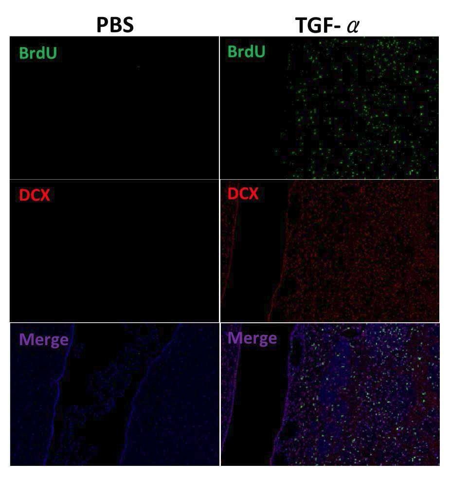 뇌허혈손상 동측부위의 뇌실막밑구역에서 TGF-α의 투여에 의한 DCX 및 BrdU 양성세포의 변화