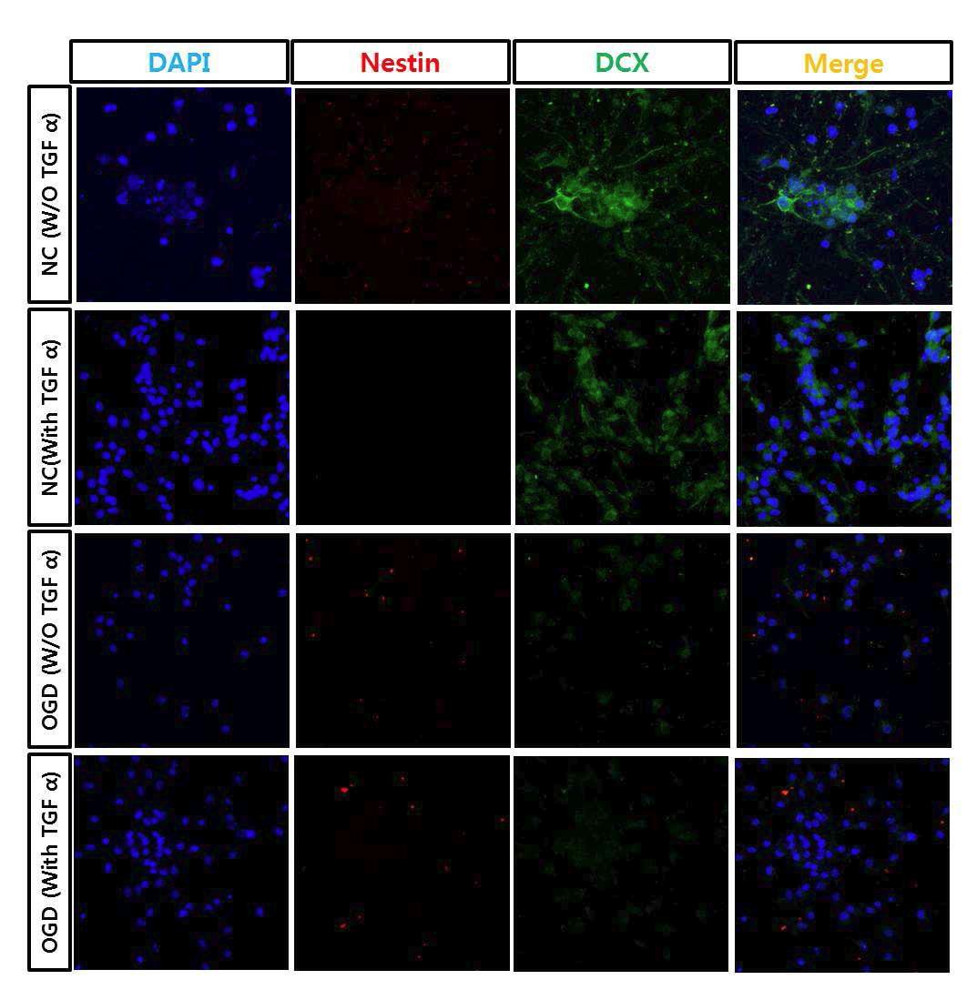TGF-α에 의한 신경줄기세포의 Nestin, DCX 발현 변화