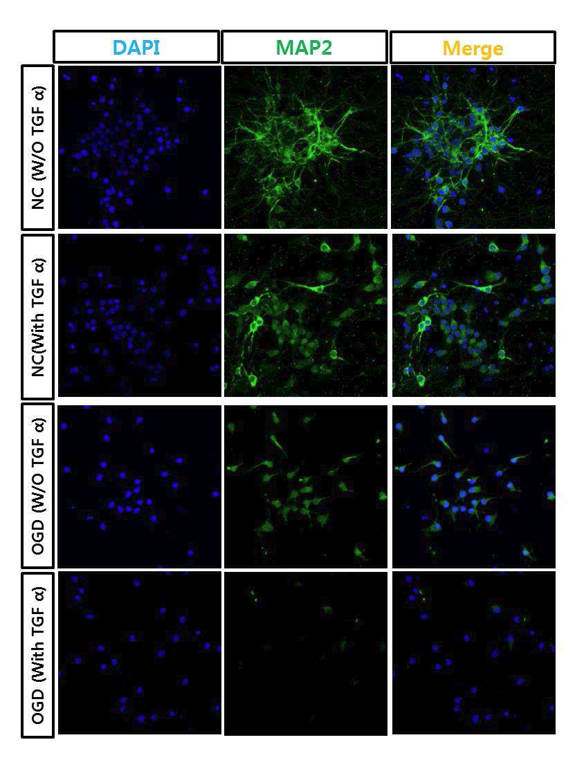 TGF-α에 의한 신경줄기세포의 MAP2 발현 변화