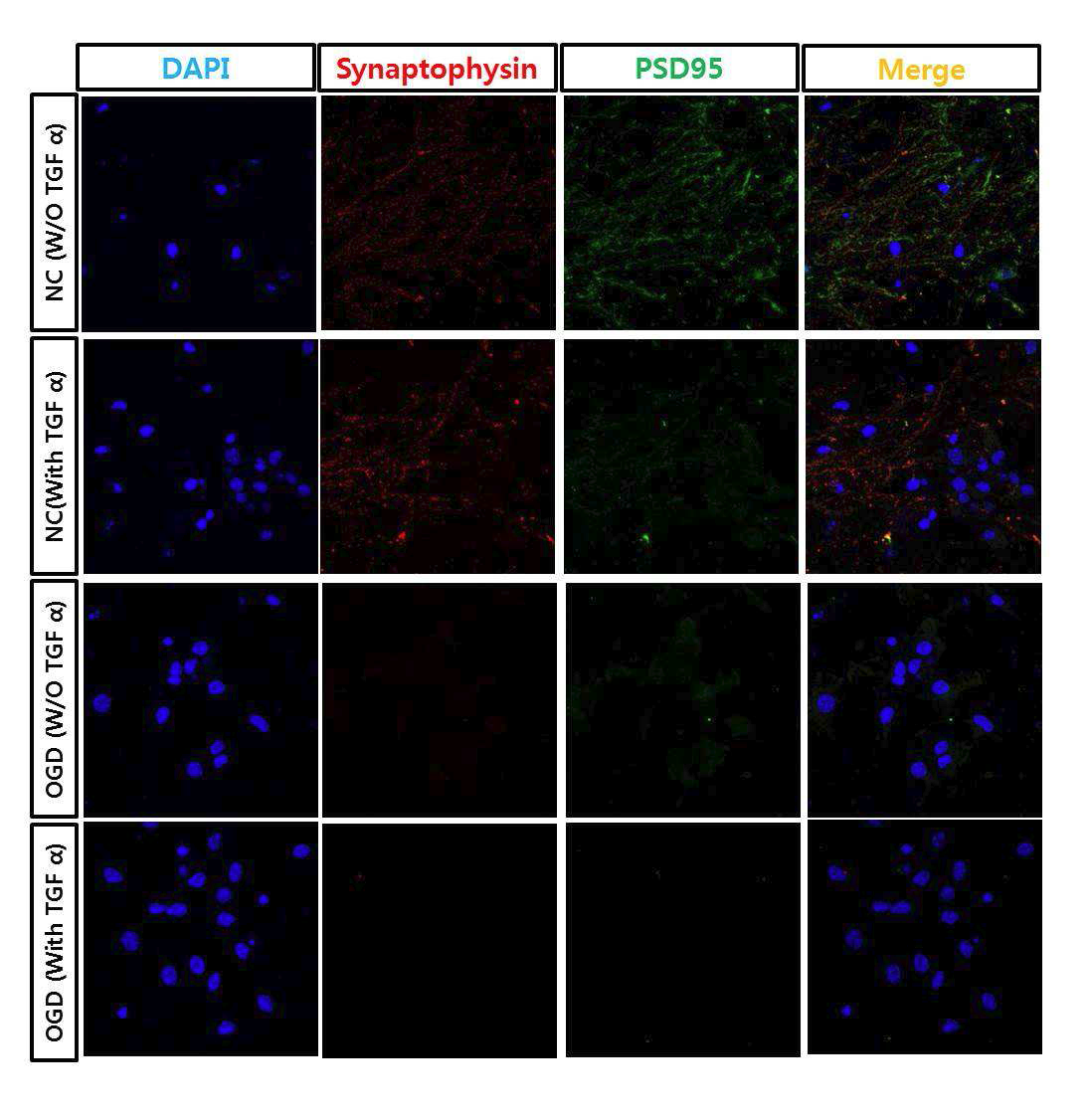 TGF-α에 의한 신경줄기세포의 Synaptophysin, PSD95 발현 변화
