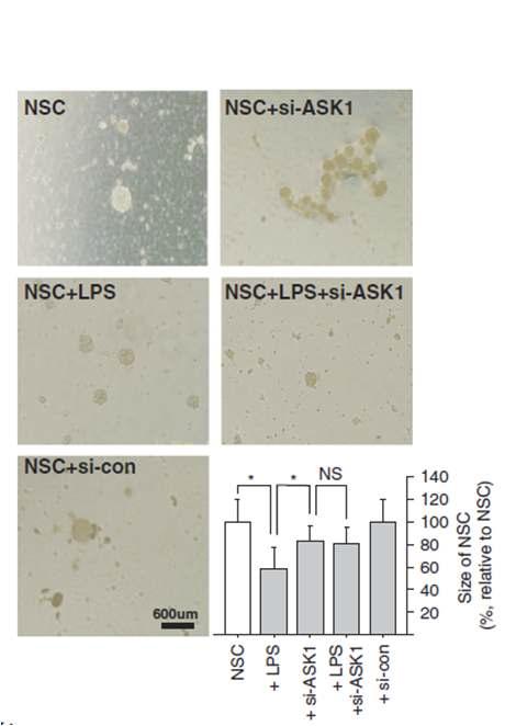 신경줄기세포에서 ASK1의 발현이 신경구의 크기에 미치는 영향