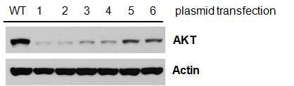 AKT shRNA plamid transfection에 의한 AKT 발현 억제