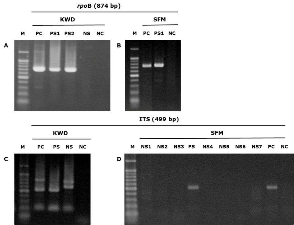 등줄쥐와 고라니로부터 Bartonella rpoB 및 ITS 유전자 단편을 증폭한 전기영동 사진.