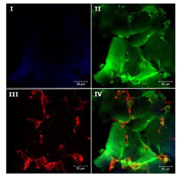 B. grahamii KRBG32 분리주에 감염된 HUVEC 세포에서 관찰된 apoptosis