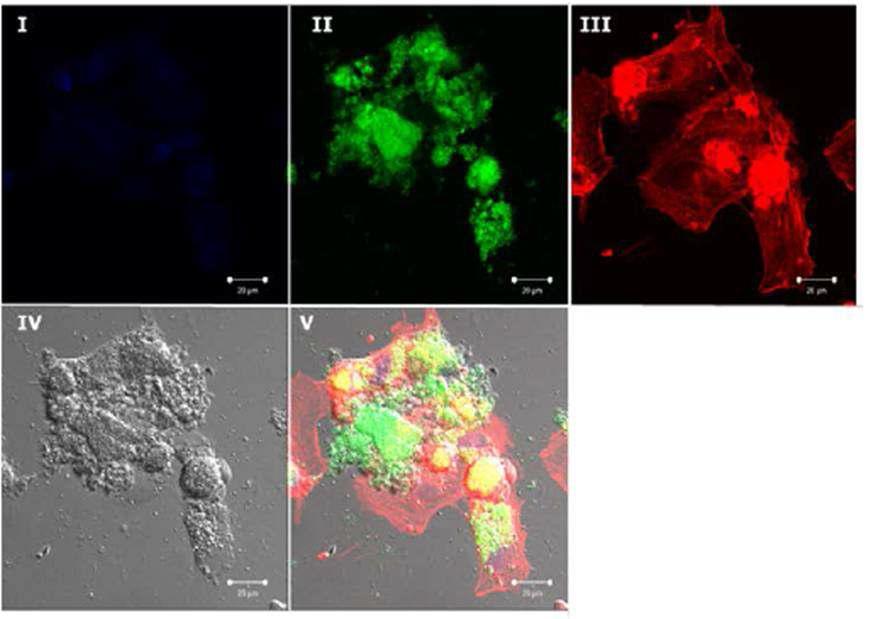 B. grahamii KRBG28 분리주에 감염된 HUVEC 세포에서 관찰된 apoptosis