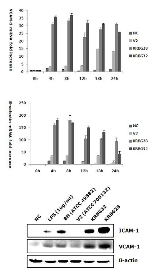 B. grahamii에 감염된 HUVEC에서 부착관련인자 분석을 위해 실시한 Real-time PCR과 western blot