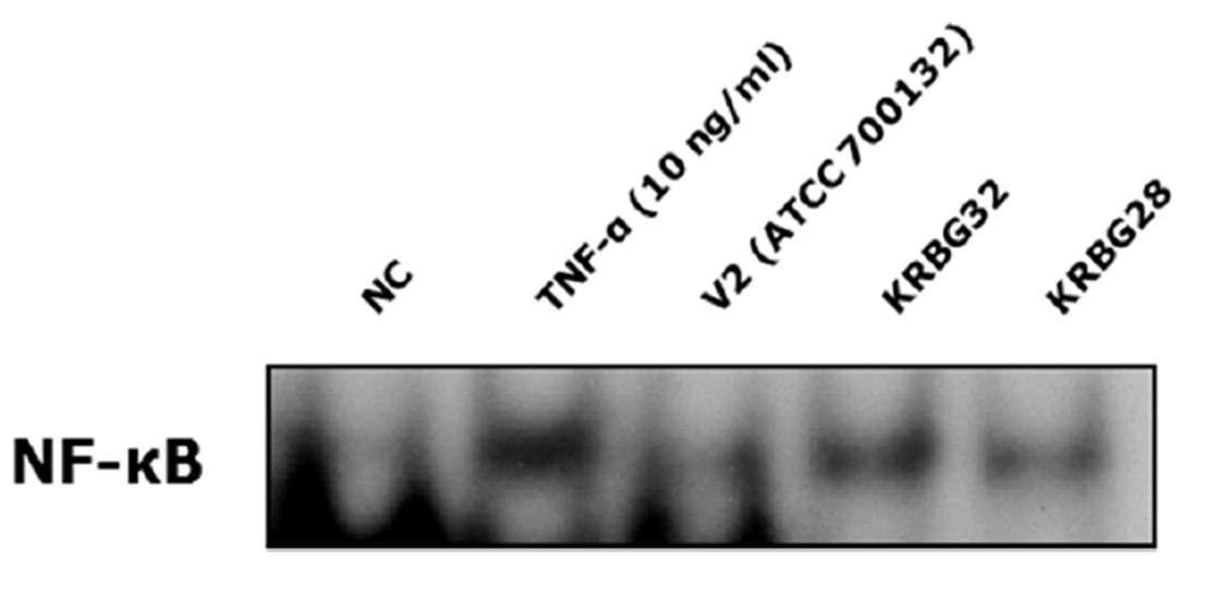 B. grahamii에 감염된 HUVEC에서 NF-κB 활성능 측정을 위해 실시한 EMSA
