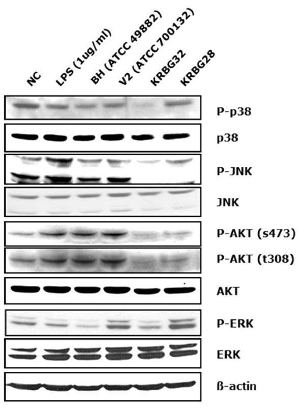 B. grahamii에 감염된 HUVEC에서 protein kinase phosphorylation 활성능 분석을 위해 실 시한 western blot