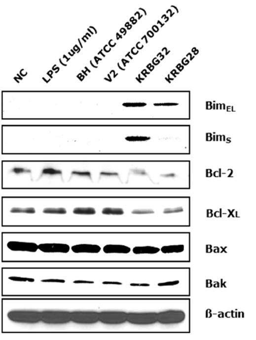 B. grahamii에 감염된 HUVEC에서 apoptosis와 연관되어 있는 단백질들의 발현 분석을 위해 실시한 western blot