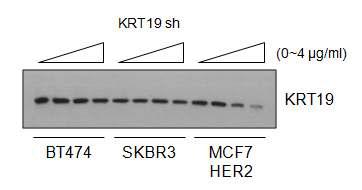 인간유방암 세포주에서 KRT19 shRNA의 농도별 트랜스펙션