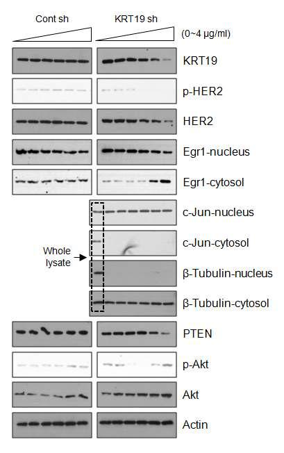 KRT19의 농도 의존적 발현 억제가 Egr-1의 핵 내로의 이동 및 세포내 신호전달에 미치는 영향