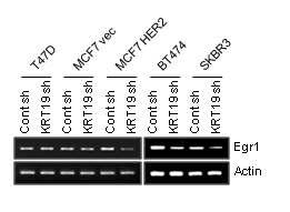 KRT19 발현억제가 인간 유방암 세포내 Egr-1 mRNA 발현에 미치는 영향 검증