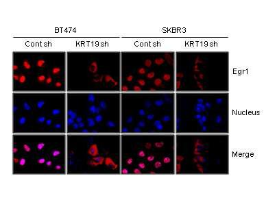 KRT19 발현억제가 인간 유방암 세포내 Egr-1 위치에 미치는 영향 검증