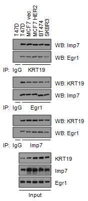 인간 유방암 세포주에서 KRT19/Egr-1/Imp7 간의 물리적 결합