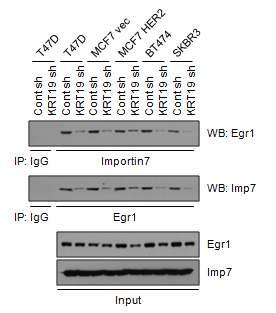 KRT19 발현 억제에 따른 Egr-1/Imp7 간의 물리적 결합력 저해
