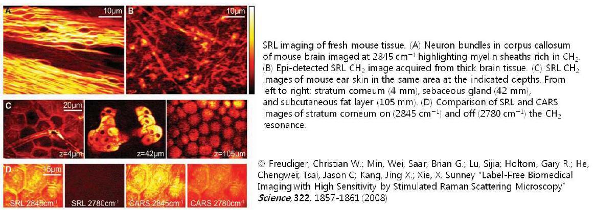 2008년 Science 저널에 소개 된 SRS(Stimulated Raman Scattering) 이미징 기술