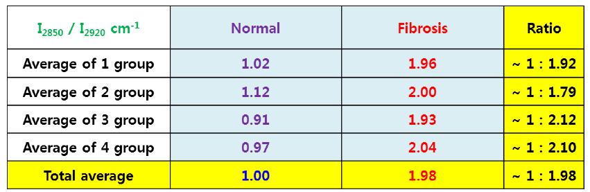 정상과 간섬유화 조직의 신호세기의 크기 비교