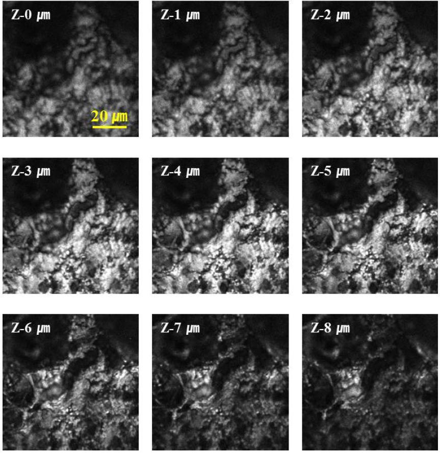 CARS 분광 이미징 시스템을 이용하여 간섬유화 (hepatic fibrosis) 샘플을 깊이 별로 측정한 대표 2D 이미지.