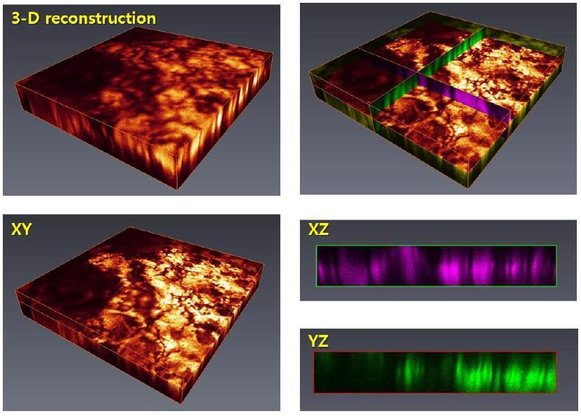 CARS 분광 현미경을 이용한 간 섬유화 조직의 3차원 바이오 이미징.