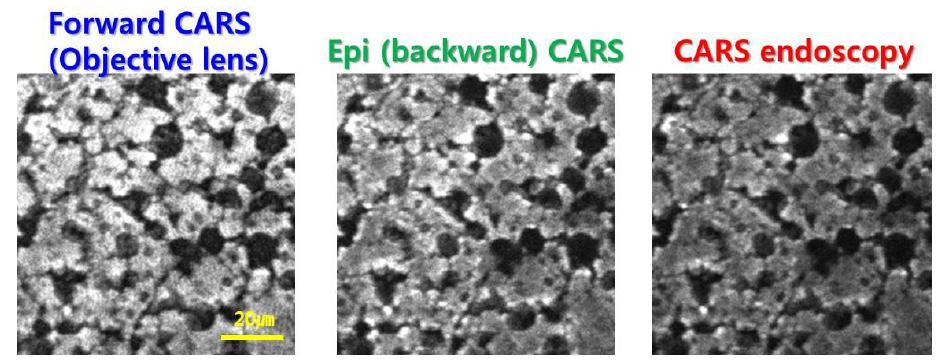 간섬유화 조직 샘플을 이용하여 일반 대물렌즈로 측정한 CARS와 CARS 내시경을 비교한 이미지.