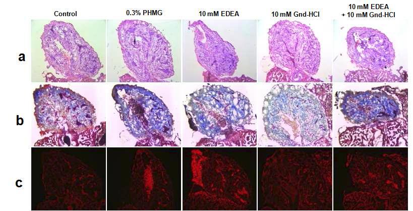 Histologic analysis of longitudinally cross-sectioned bulbous artery and heart following death by exposure to disinfectant solution. All images were obtained at 400x magnification. a. Hematoxylin & Eosin staining b. Masson’s trichrome staining to visualize collagen fibrosis and accumulation. c. DHE staining.