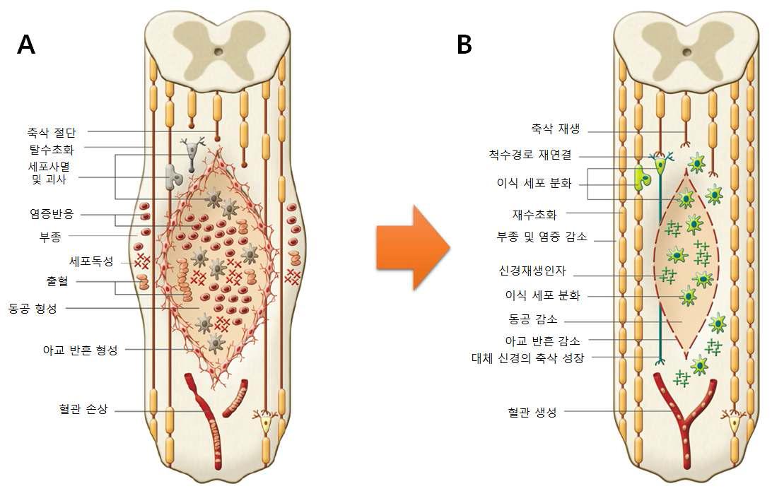 손상된 척수에서 일어나는 병태생리학적 변화(A)와 줄기세포 이식으로 기대되는 치료 효과(B)
