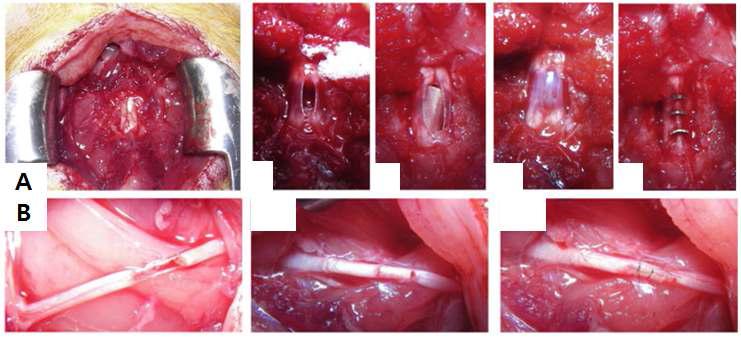 흰쥐의 척수완전절단모델(A) 과 좌골신경절단모델(B) 내 스캐폴드 이식 장면