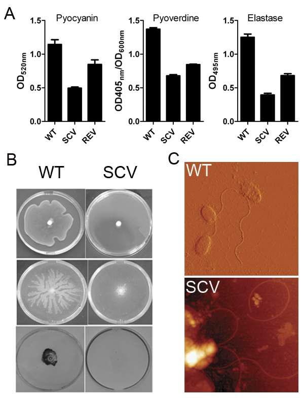 P . aeruginosa의 야생 형 균주와 SCV의 표현형의 차 이