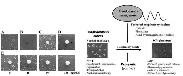 Staphylococcus aureus와 P seudomonas aeruginosa 의 공동배양에서 SCVs의 형성 확인 (좌) 및 SCVs와 normal cell의 표현형 비교 모식도 (우) : S. aureus는 SCVs를 형성하게 되고 항생제의 저항성을 획득하는 표현형을 보임