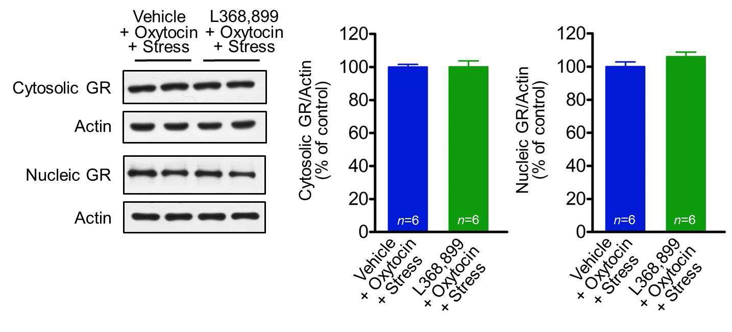 Oxytocin receptor antagonist의 전처리는 cytosol과 nucleus의 GR signal에 아무런 영향을 미치지 않음