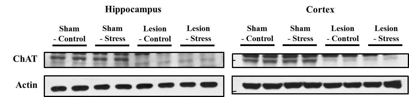해마와 피질에서 ChAT에 대한 신호를 Western blot을 통하여 확인
