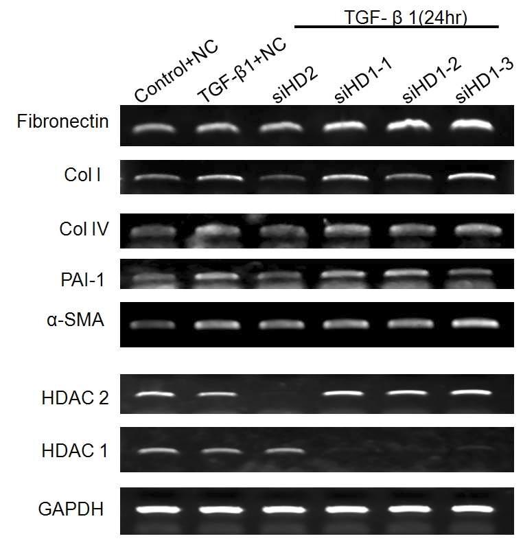 음경만곡증 환자의 섬유화병변에서 분리된 섬유모세포에 HDAC1, HDAC2 siRNA를 처리 후 knockdown을 유도.