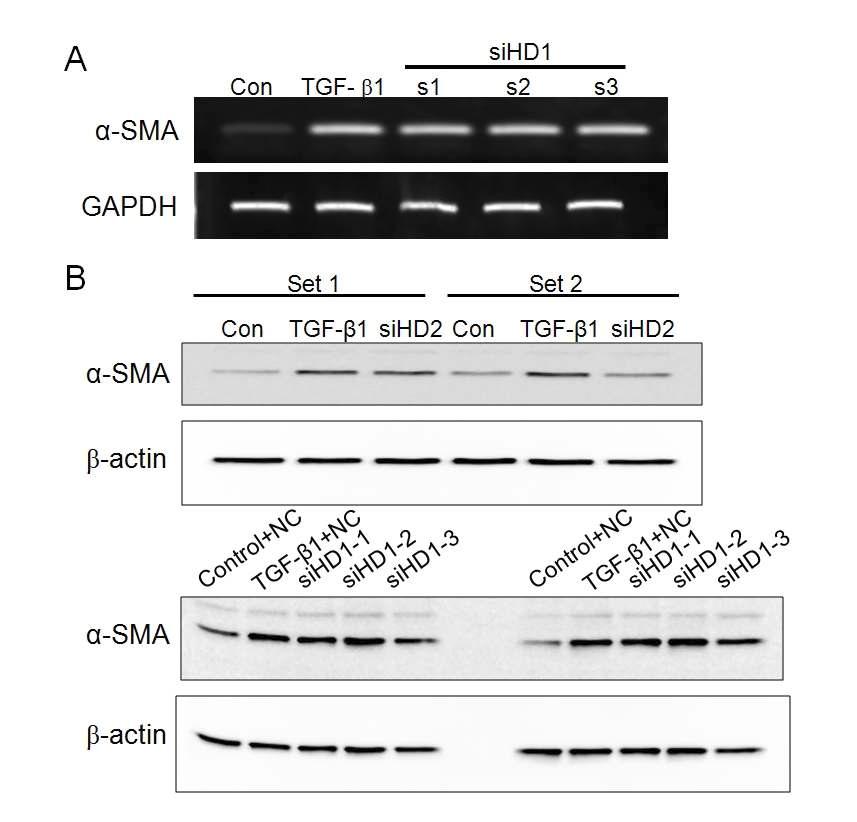 음경만곡증 환자의 섬유화병변에서 분리된 섬유모세포에 HDAC2, HDAC6 siRNA 처리 후 knockdown을 유도. TGF-β1 투여 후 α-SMA 발현이 증가하였고, HDAC2 siRNA 처리군에서 α-SMA 발현이 감소한 반면, HDAC1의 경우 3종류의 siRNA 모두 α-SMA 발현을 감소시키지 못함. RT-PCR (A), Western blot (B).