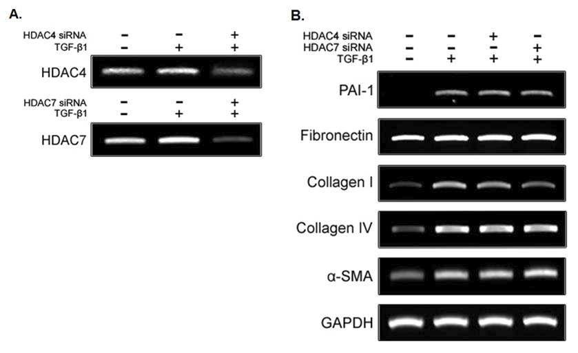 음경만곡증 환자의 섬유화병변에서 분리된 섬유모세포에 HDAC4 또는 HDAC7 siRNA 처리 후, HDAC4 또는 HDAC7의 knockdown을 유도함 (A). HDAC4 또는 HDAC7의 inhibition이 TGF-β1 신호전달에 의한 ECM mRNA 중 collagen Ⅰ의 합성 증가를 성공적으로 억제하지만, 그 외 mRNA 발현에는 영향을 미치지 않음 (B).