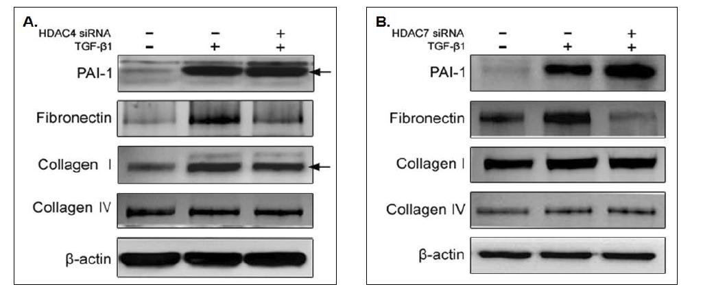 음경만곡증 환자의 섬유화병변에서 분리된 섬유모세포에 HDAC4 또는 HDAC7 siRNA 처리 후, HDAC4 또는 HDAC7의 knockdown을 유도함. HDAC4 siRNA 투여 후 fibronectin, collagen I 단백질 발현이 감소하였고 (A), HDAC7 siRNA 투여 후 fibronectin 발현이 감소하였지만 그 외 ECM 단백질 발현에는 영향을 미치지 않았음 (B). 그리고 그림 1의 RT-PCR 결과와 약간 상이한 양상을 보임.