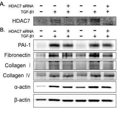 음경만곡증 환자의 섬유화병변에서 분리된 섬유모세포에 HDAC7 siRNA 처리 후, HDAC7의 knockdown을 유도함 (A). HDAC7의 inhibition이 TGF-β1 신호전달에 의한 ECM protein 및 α-SMA protein 발현을 현저하게 억제함 (B).