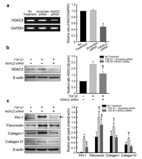 음경만곡증 환자의 섬유화병변에서 분리된 섬유모세포에서 HDAC2 siRNA 처리 후, HDAC2의 knockdown을 유도함(a). Western blot을 통해 HDAC2 단백발현에 영향을 미치는 TGF-β1효과를 확인함(b). ECM protein, 즉 PAI-1, fibronectin, collagen Ⅰ, collagen Ⅳ의 발현이 TGF-β1 처리 후 현저하게 증가하였고, HDAC2 siRNA 투여는 TGF-β1에 의한 ECM 단백발현을 현저하게 억제함(c).