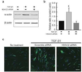 음경만곡증 환자의 섬유화병변에서 분리된 섬유모세포에서 HDAC2 siRNA로 인해 HDAC2 의 knockdown을 유도. HDAC2 siRNA 투여 후 myofibroblast marker인 α-actin 단백발현이 감소하는 양상을 보임 (a,b) α-actin 발현이 감소하는 양상을 보임(c)