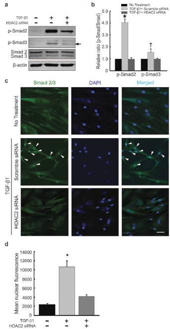 TGF-β1 처리 후 Smad2 및 Smad3의 인산화 (phosphorylation)가 유도됨. HDAC2 siRNA 투여 후 TGF-β1 신호전달에 의한 Smad2의 인산화를 현저하게 억제하였고, Smad3의 인산화도 억제됨(a,b,c)