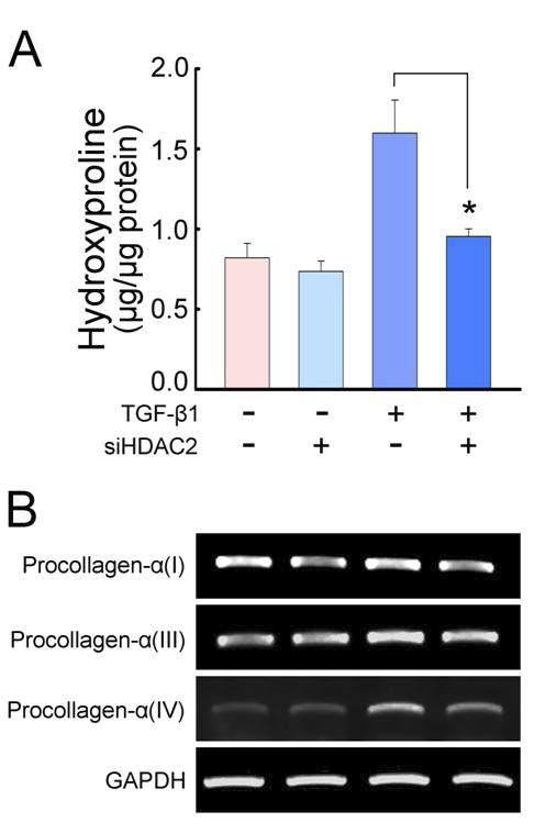 음경만곡증 환자에서 분리한 섬유모세포에 HDAC2 siRNA 처리시 hydroxyproline과 procollagen이 감소함. 음경만곡증 환자에서 분리한 섬유모세포에 Lipofectamine을 이용하여 48시간동안 형질주입을 한뒤 24시간동안 TGF-β1 처리시 hydroxyproline assay 와 PCR을 이용한 procollagen의 발현변화를 관찰한 결과 HDAC2 siRNA를 처리한 군에서 감소하는 것을 확인함