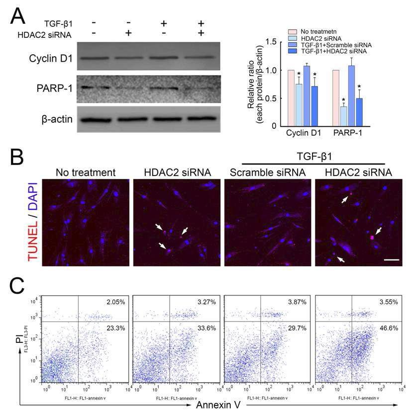 음경만곡증 환자에서 분리한 섬유모세포에 Lipofectamine을 이용하여 48시간동안 형질주입을 한 뒤 24시간동안 TGF-β1 처리 시 western blot 및 TUNEL assay, FACS를 통하여 확인을 하였음. 음경만곡증 환자에서 분리한 섬유모 세포에 HDAC2 siRNA 처리시 세포주기를 억제하고(A) 및 세포자살을 촉진함(B, C).