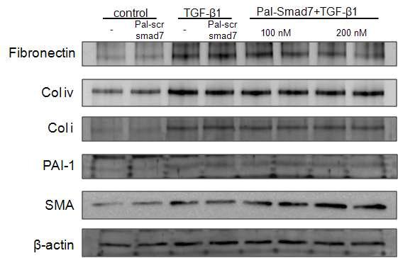 TGF-β1 처리 후 ECM protein 발현이 현저하게 증가함. Pal-Smad7을 100 nM과 200 nM을 처리시, ECM protein인 fibronectin이 현저하게 감소함. Collagen Ⅰ, collagen IV, PAI-1은 Pal-Smad7 처리 후 변화 없거나 아주 경미한 감소를 보임. 그러나 myofibroblast marker인 α-SMA는 오히려 Pal-Smad7 처리 시증가하는 경향을 보임.