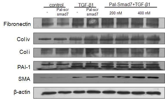 Pal-Smad7을 200 nM과 400 nM로 농도를 증가시킨 경우에도 그림 1과 비슷한 경향을 보임.