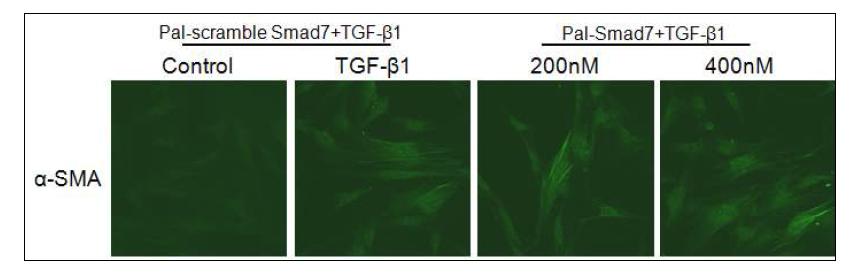 음경만곡증 환자의 섬유화병변에서 분리된 섬유모세포에서 Pal-Smad7 투여 후 myofibroblast marker인 α-SMA protein 발현은 큰 변화를 보이지 않음.