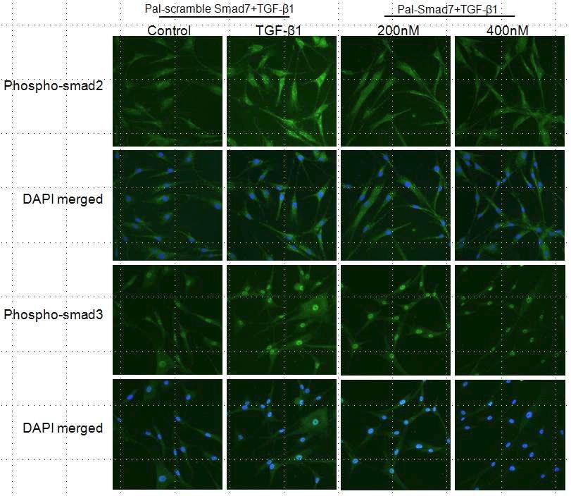 TGF-β1 처리 후 phospho-Smad2 및 phospho-Smad3의 발현이 증가됨. Pal-Smad7이 TGF-β1 신호전달에 의한 phospho-Smad2 및 phospho-Smad3의 발현을 현저하게 억제함.