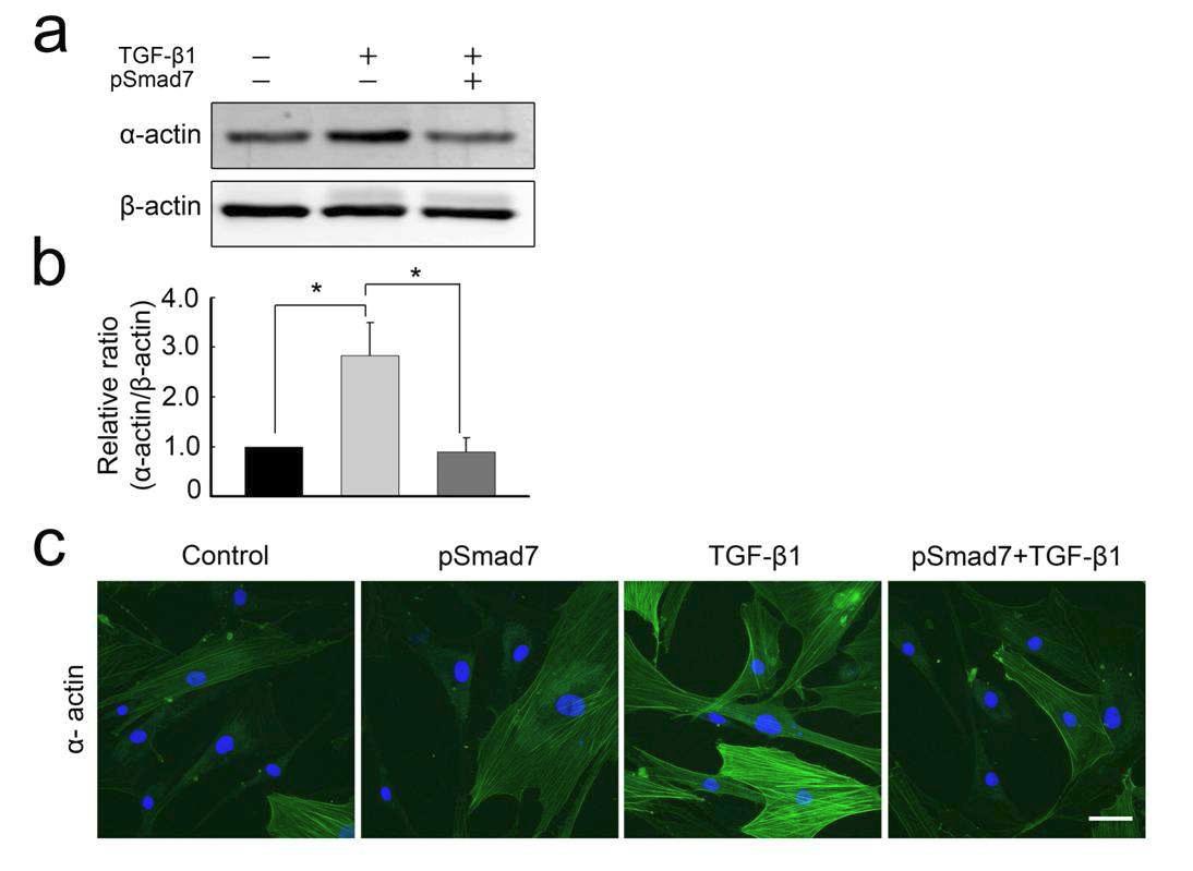 TGF-β1에 의해 fibroblast가 myofibroblast로 전환되었으나, Smad7을 형질주입한 군에서는 α-SMA의 발현양이 현저하게 감소됨. 이는 TGF-β1에 의한 myofibroblast로의 전환이 억제됨을 확인함.