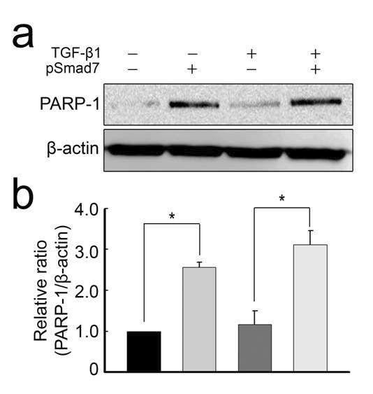 Smad7 plasmid를 형질주입하여 과발현을 유도한 군에서는 PARP-1이 증가됨. TGF-β1에 의해서는 PARP-1의 발현변화는 없음을 확인함.