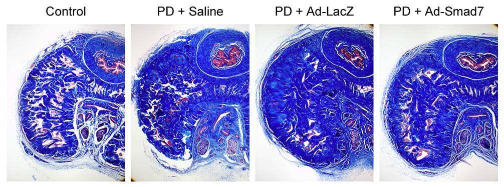 Masson trichrome 염색. Adenoviral Smad7 유전자가 주입된 군에서는 fibrin에 의해 유도된 섬유화 병변 부위가 saline만 투여한 대조군에 비해 현저하게 감소됨을 확인함.