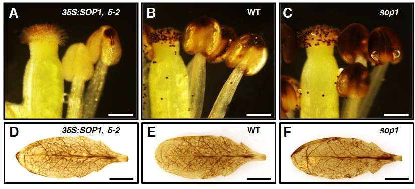 DAB staining. (A) 35S:SOP1, 5-2의 anther. (B) Wild type의 anther. (C) sop1의 anther. (D) 35S:SOP1, 5-2의 leaf. (E) Wild type의 leaf. (F) sop1의 leaf.