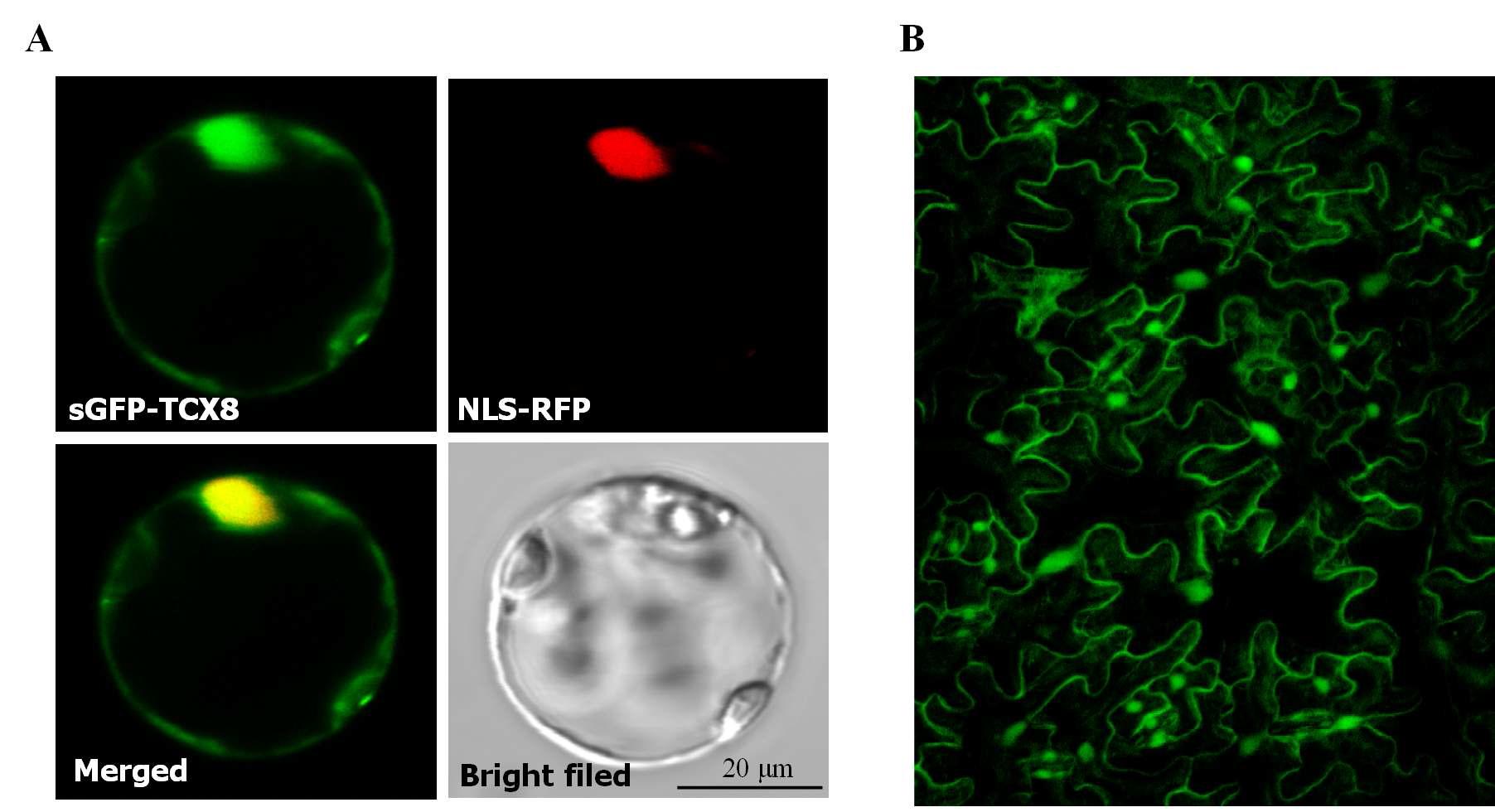 sGFP-TCX8의 subcelluar localization 확인. (A) 원형질체. (B) 엽육세포.